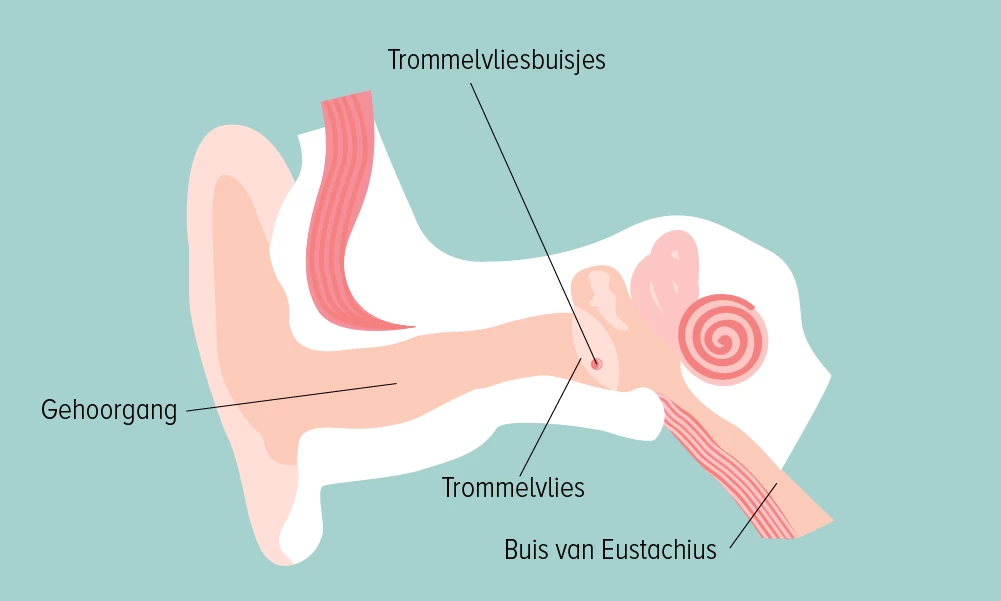 Alles over trommelvliesbuisjes